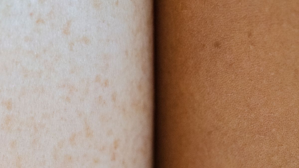 Pürüzsüz ve eşit tonlu cilde serum uygulayan kadın
